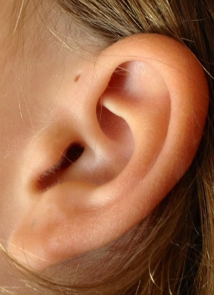 People Are Realizing That Those Tiny Holes Above Their Ears May Have An Evolutionary Explanation