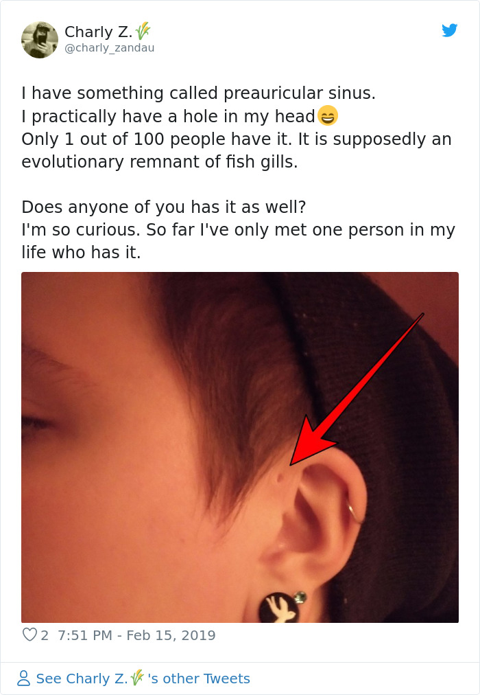 People Are Realizing That Those Tiny Holes Above Their Ears May Have An Evolutionary Explanation