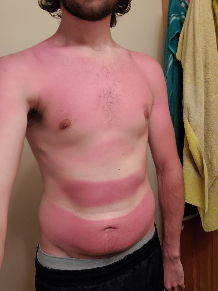 Long Kayaking Trip + Belly Rolls = Most Inconsistent Sunburn Ever
