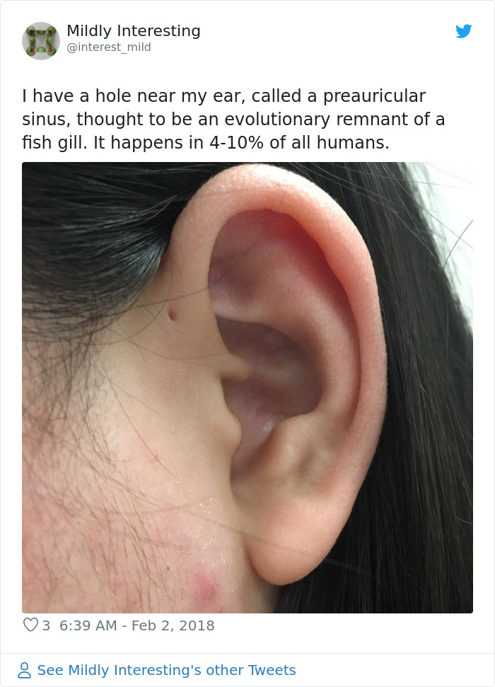 aluminium Overflod Landbrug People Are Realizing That Those Tiny Holes Above Their Ears May Have An  Evolutionary Explanation | Bored Panda