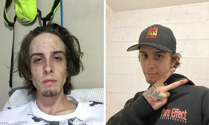 Guy Shares Pics Before And 745 Days After Quitting Drugs And The Transformation Is Incredible