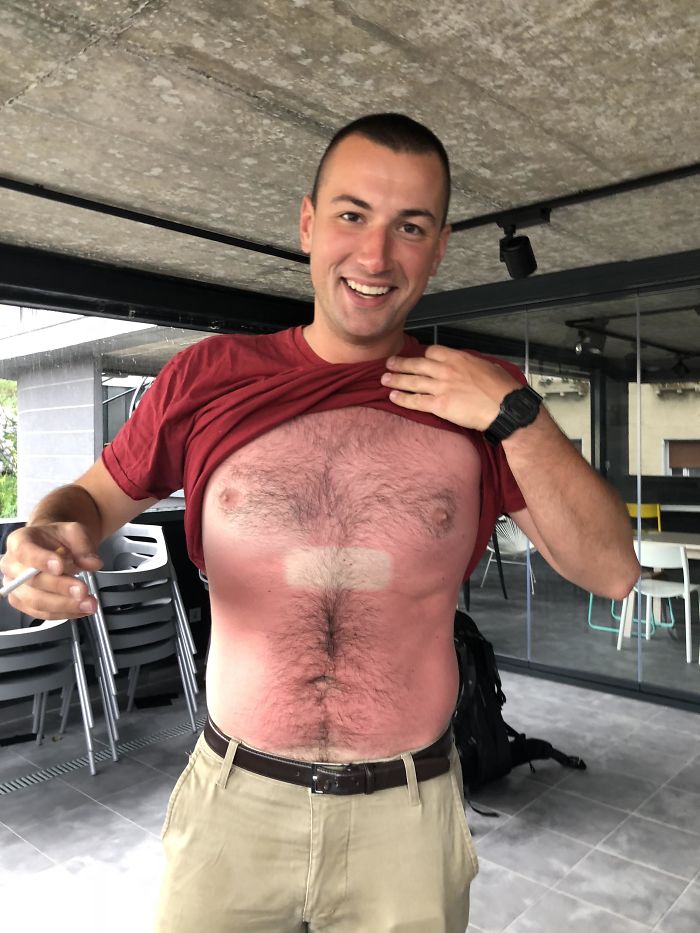 Met A Guy Last Summer That Fell Asleep In The Sun With His Phone On His Chest