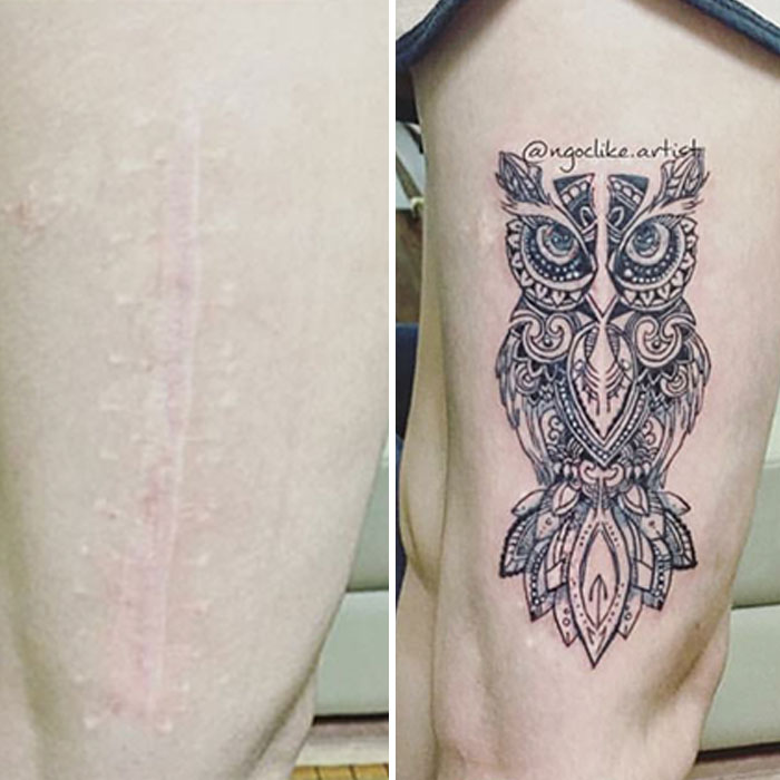 Tattoo Artist Makes Real Works Of Art Covering Sad Scars