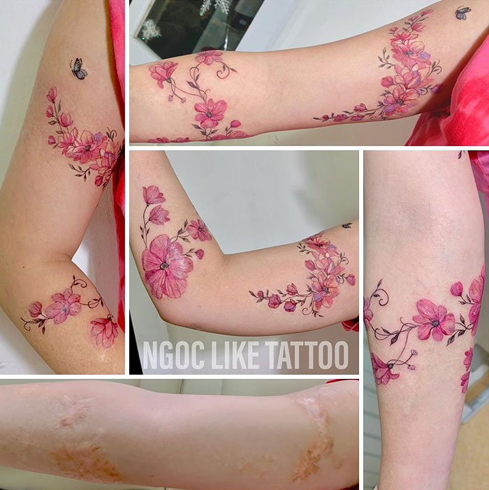 30 Times People Asked To Cover Up Their Scars, And This Tattoo Artist Nailed It