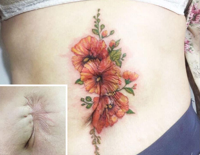 Tattoo Artist Makes Real Works Of Art Covering Sad Scars