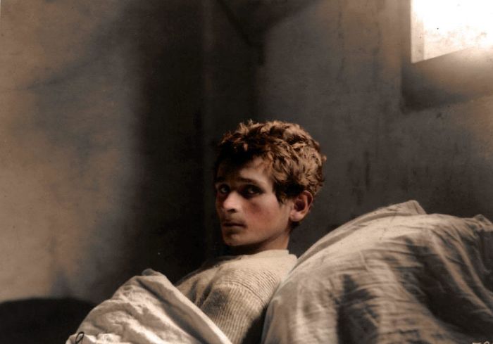 Guiseppe Uggesi, An Italian Soldier In 223rd Infantry, Who Was In An Austrian Prison Camp At Milowitz, Seen Here Confined To Bed With Tuberculosis In January Of 1919
