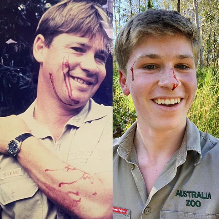 Robert Irwin Gets Bitten In The Face By A Snake, Happily Poses For A Photo Afterwards
