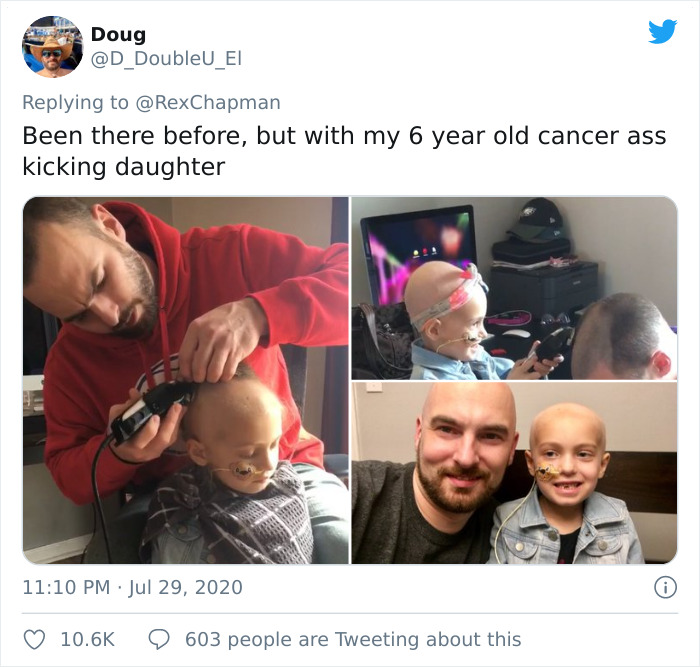 Boyfriend Shaves Girlfriend's Head Due To Alopecia Only To Shave His Own Immediately