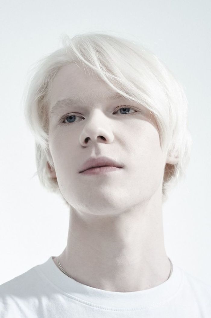 Ilya, An Albino
