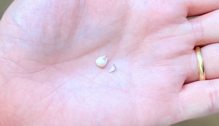 My Daughter And My Kitten Lost Their Baby Tooth In The Same Day