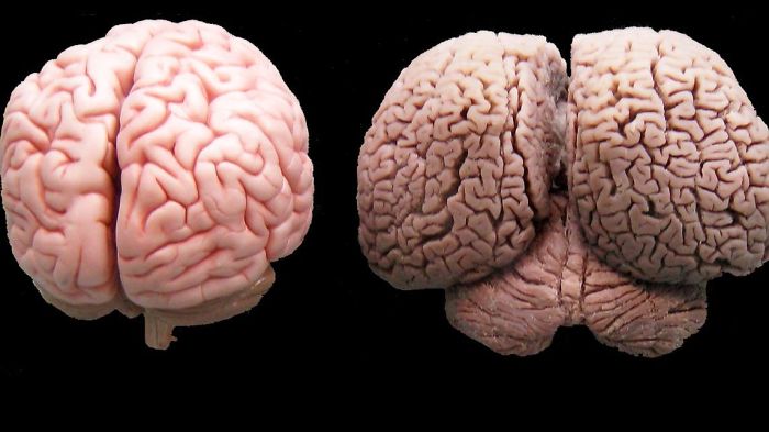 A Human Brain On The Left, A Dolphin Brain On The Right