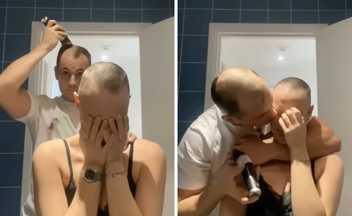 Boyfriend Shaves Girlfriend's Head Due To Alopecia Only To Shave His Own Immediately