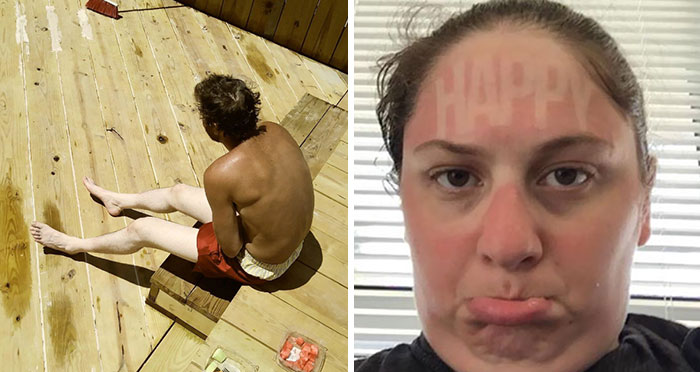 “Always Wear Sunscreen!”: 40 People Who Failed To Do It And Ended Up Looking Like Dorks