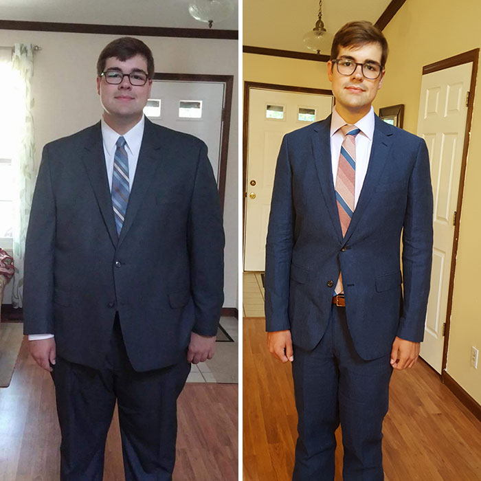 140 Lb Weight Loss And Living With It