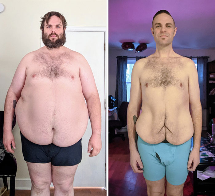 165 Lbs Down (From 375 To 210 In 2 Years On Keto)