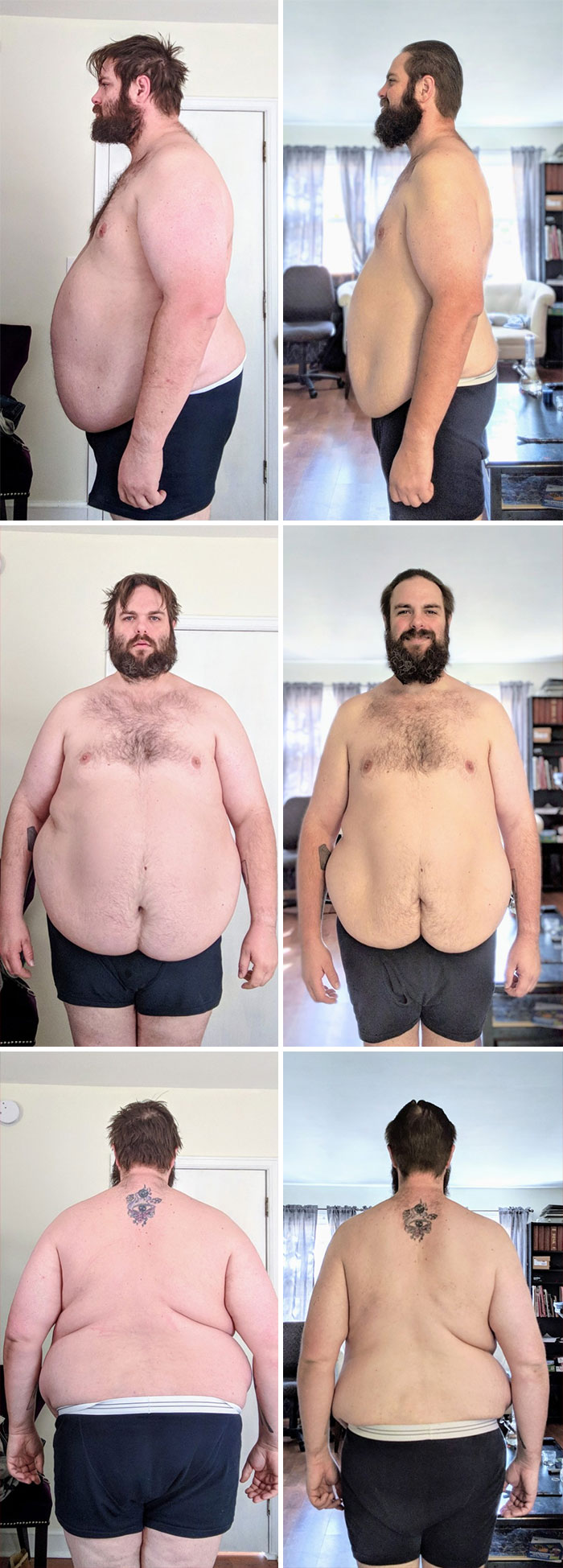101 Lbs Down In 8 Months Doing Keto