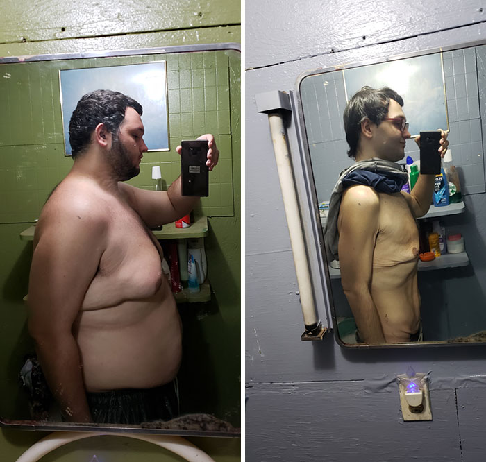 I Was 360 Lbs Last June And Now I'm Down To 172 Lbs
