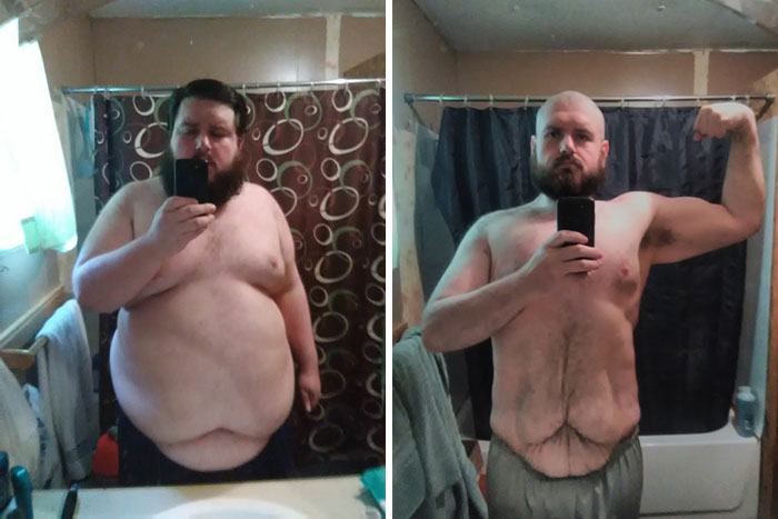 1 Year Progress. 425 Lbs To 249 Lbs Through Diet And Exercise