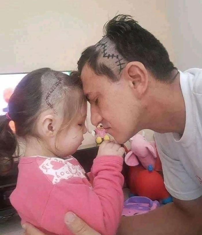 Great What This Father Did After His Daughter's Head Was Opened For Surgery