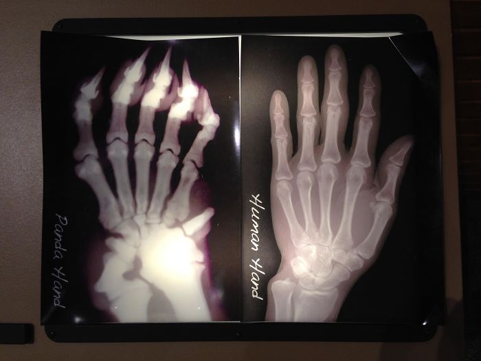 X-Ray Of A Panda Hand vs. A Human Hand; Pandas Have An Extra "Thumb" To Help Grip Bamboo Stalks
