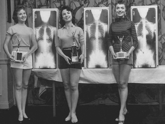 Miss Correct Posture, 1956. At A Chiropractic Convention In Chicago, The Contest Winners Were Picked For The Beauty Of Their X-Rays And Their Standing Posture