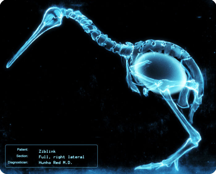 X-Ray Of A Kiwi Bird With Its Egg