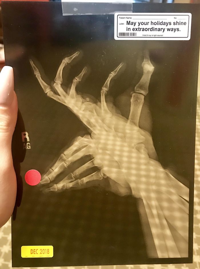 Doctor’s Office Christmas Card Is An X-Ray Made To Look Like Rudolph
