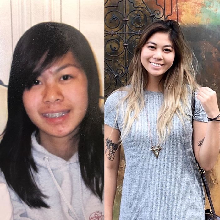 15 To 22, Traded In The Braces And Acne In Exchange For A Healthy Dose Of Self Confidence And The Ability To Smile
