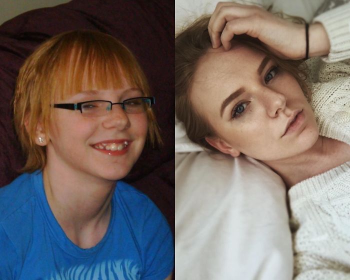 13 To 20 (My Mom Gave Me That Haircut)