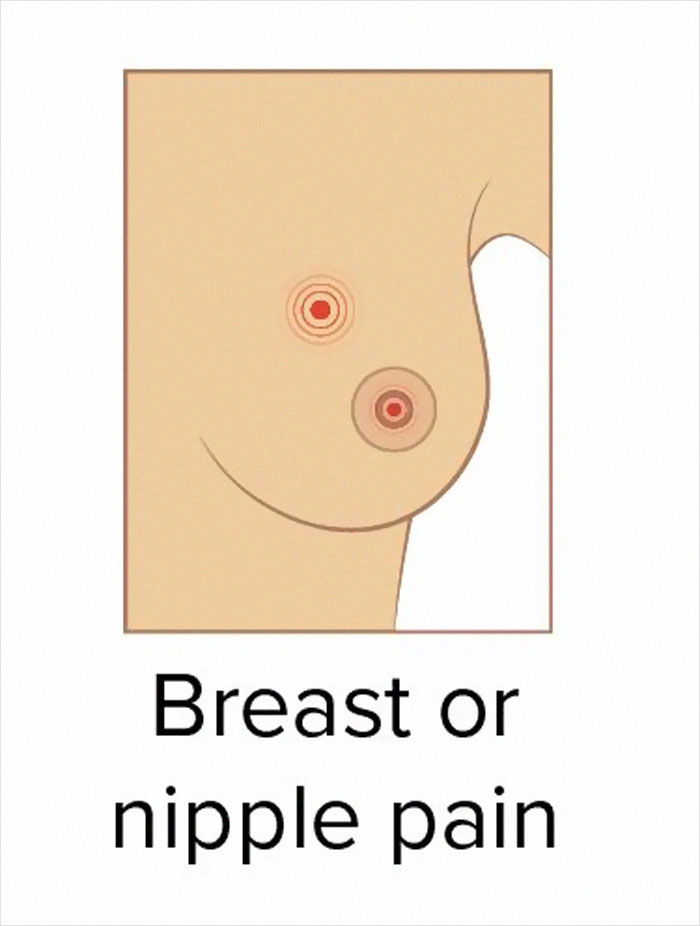 These 9 Pics Showing The Common Signs Of Breast Cancer Are A Must-See For Everyone