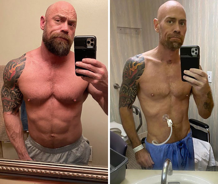 What Mike Schultz Looked Like After Battling Covid-19 For 6 Weeks In The Hospital