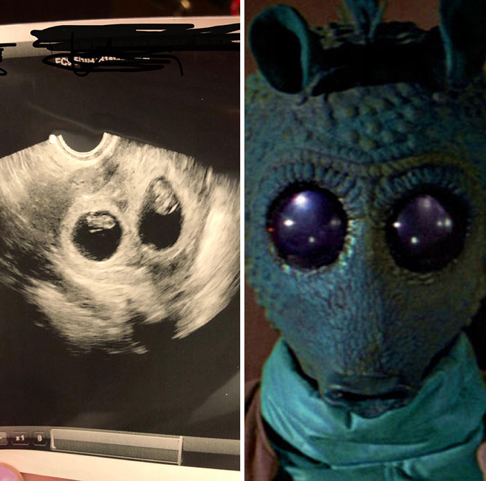 My Wife’s Ultrasound (Twins) Reminded Me Of Something
