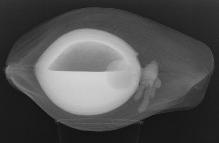 X-Ray Of A Coconut