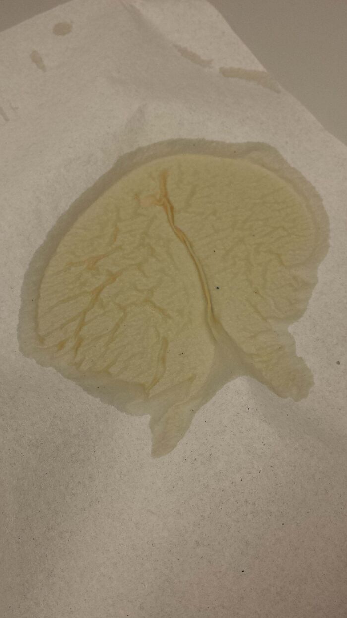 My Coffee Spill Clean-Up Looks Like A Brain