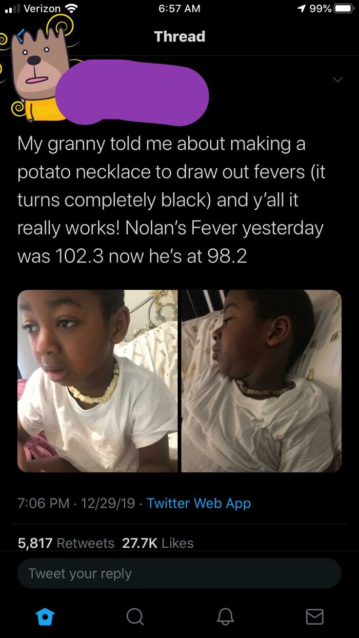 27.7k People Believe This Is The Potato Drawing Out The Fever And Not Oxidizing... These Poor Kids