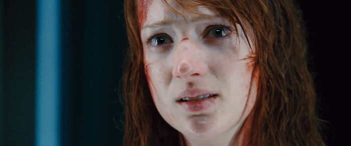 In Cabin In The Woods (2011) After The Rv Crash And Redneck Zombie Ass-Kicking, Dana's Pupils Are Shown To Be Different Sizes. This Is A Common Symptom Of A Concussion
