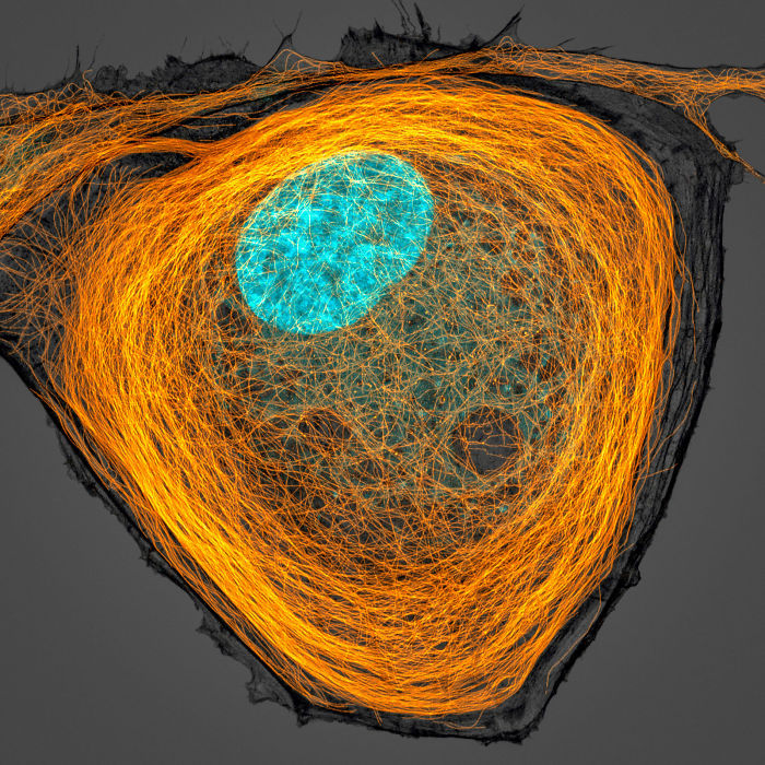 Microtubules (orange) inside a cell