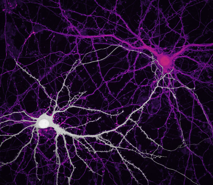 Connections between brain cells