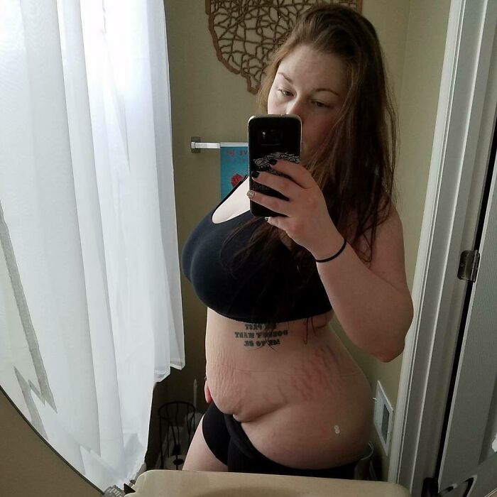 "This Is My Postartum Body. 10 Weeks After The Birth Of My Beautiful Daughter"