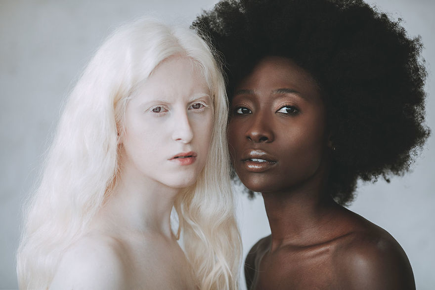 Photographer Created A Concept Called Sun And Moon With Albino And Black Woman