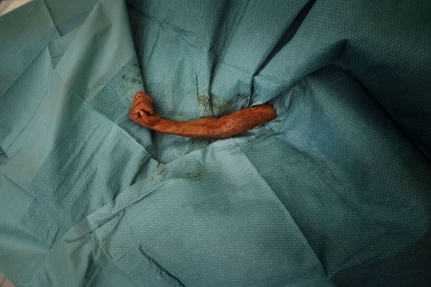 Baby Orangutan Surgery (Honorable Mention In Documentary & Photojournalism Category)