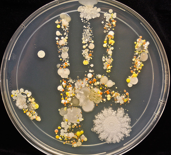 What Happens If An 8-Year-Old Puts His Hand In A Petri Dish Of Agar