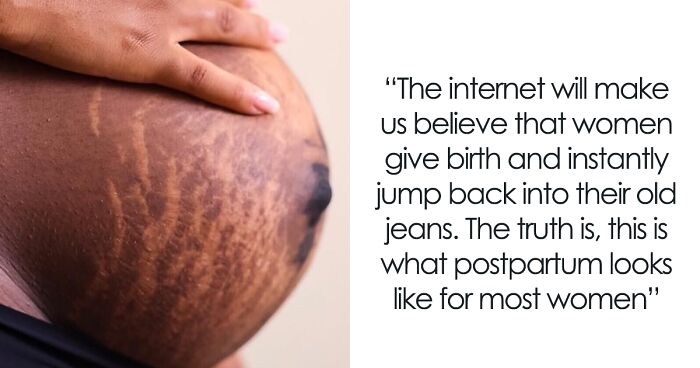 Women Are Sharing Honest And Raw Photos Of Postpartum Bodies That