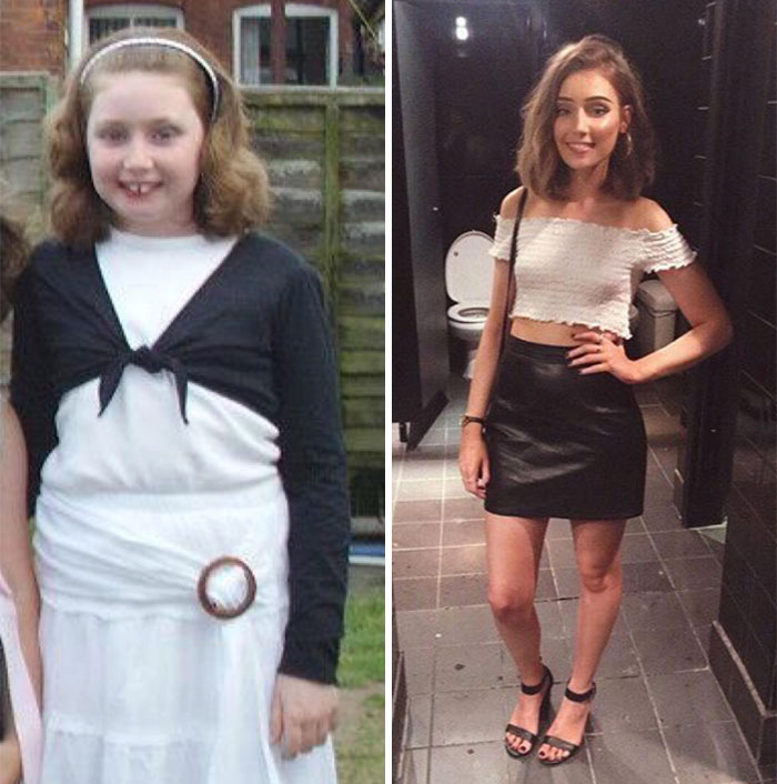 12-23 Puberty And Private Dentistry.. And Let’s Not Forget Fake Tan And Makeup Get A Lot Of Credit Here!