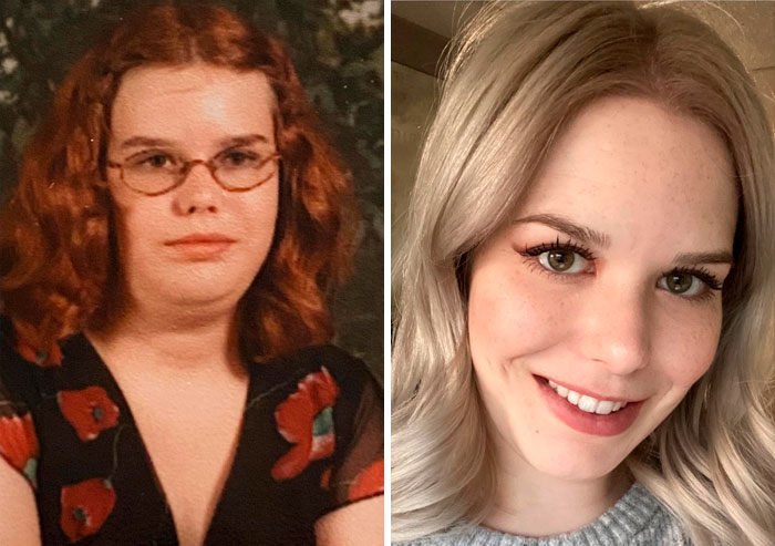 12-27. Lost A Chin, But Gained A Smile