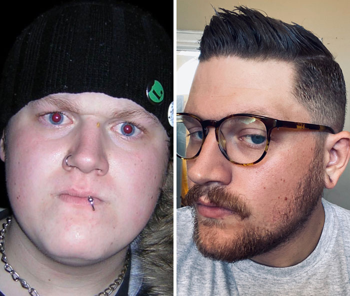 Then: 320 Lbs, Face Always Red, Angry At Dad, Ready To Die For Punk Rock. Now: 250 Lbs, Skin Healthier, Love My Dad, Punk Rock Is Pretty Ok But Being An Adult Is Pretty Ok Too