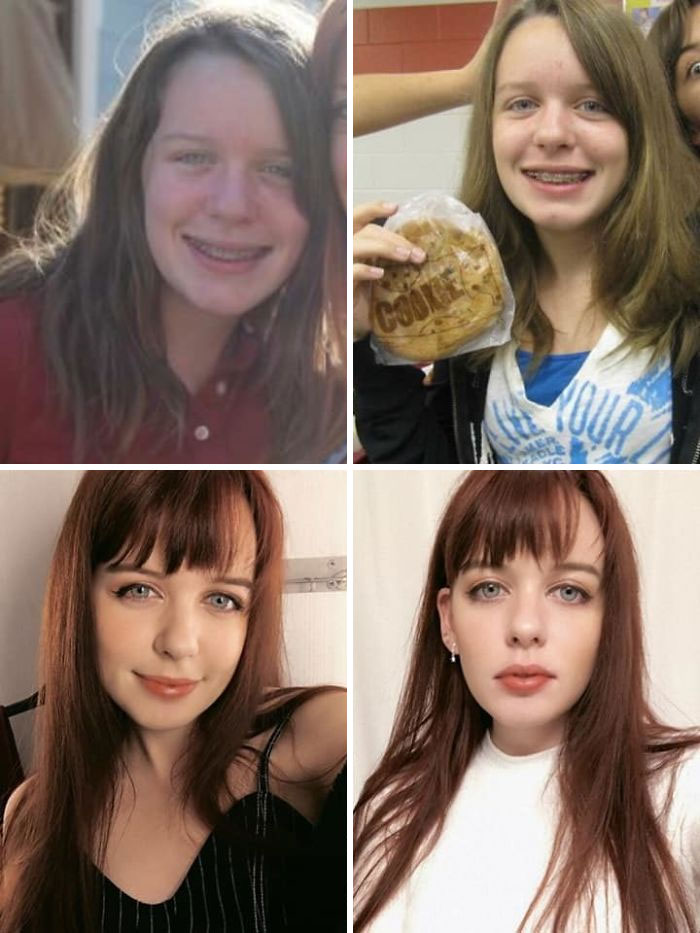 12 vs. 20. Had To Stop Riding The Bus+change My Classes In Middle School Because I Was Bullied So Bad For "Being Ugly"