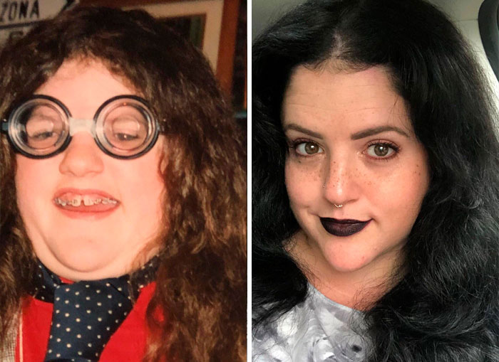 People Who Used To Be “Ugly Ducklings” Share Their Transformations, And We Can Barely Recognize Them