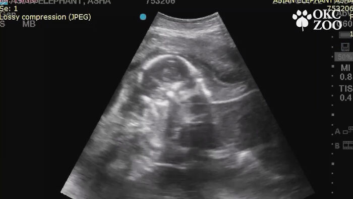 Zoo Shares An Ultrasound Of A Baby Elephant And People Find It Adorable |  Bored Panda
