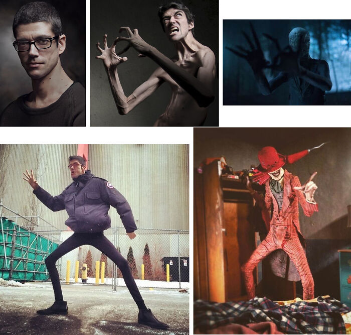 This Is Javier Botet, An Actor With Marfan Syndrome - A Genetic Disorder That Affects Connective Tissue And Makes People Grow Very Tall And Thin, With Exceptionally Long Arms And Legs. Botet Is 6′7″ Tall And Weighs 120 Pounds